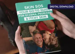 Kerassentials Skin SOS Eczema and Psoriasis Guide, a comprehensive ebook for itchy skin relief.